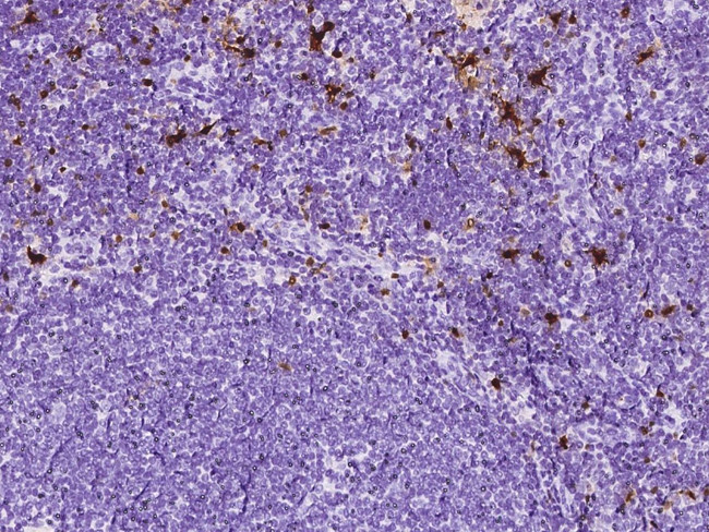 S100B Antibody in Immunohistochemistry (Paraffin) (IHC (P))