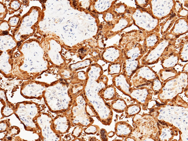 S100P Antibody in Immunohistochemistry (Paraffin) (IHC (P))