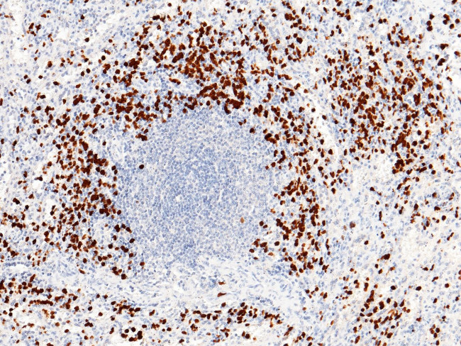 S100P Antibody in Immunohistochemistry (Paraffin) (IHC (P))