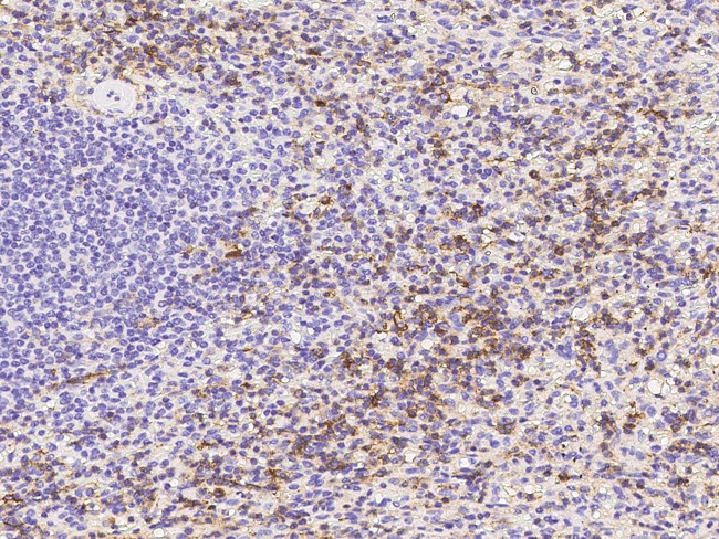 CD162 Antibody in Immunohistochemistry (Paraffin) (IHC (P))