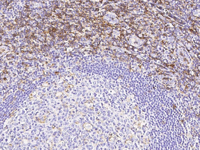 CD162 Antibody in Immunohistochemistry (Paraffin) (IHC (P))