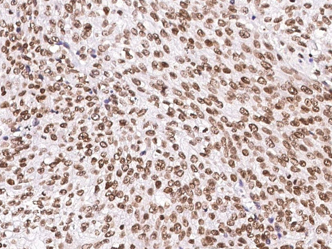 SIRT1 Antibody in Immunohistochemistry (Paraffin) (IHC (P))