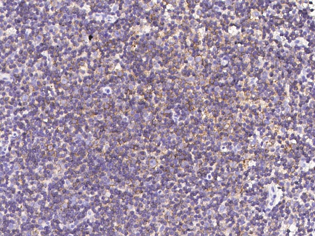 CD150 Antibody in Immunohistochemistry (Paraffin) (IHC (P))