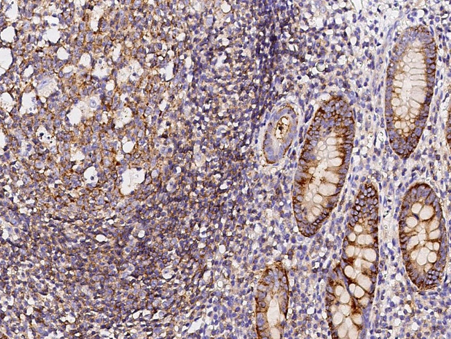 CD150 Antibody in Immunohistochemistry (Paraffin) (IHC (P))