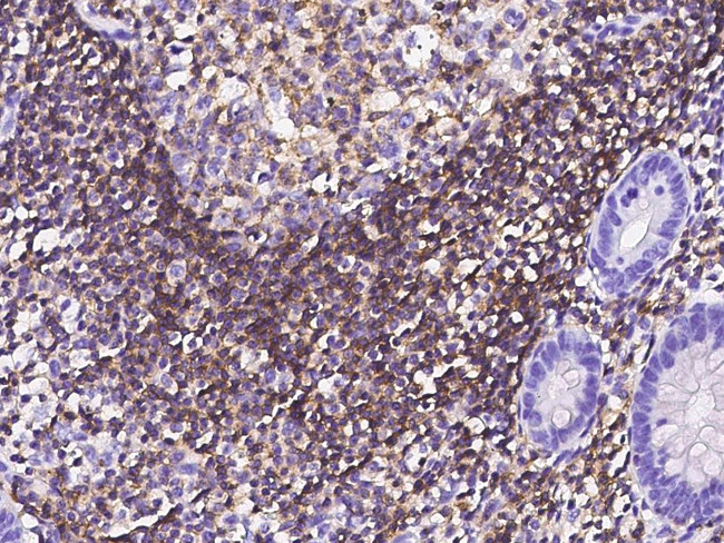 Ly-108 Antibody in Immunohistochemistry (Paraffin) (IHC (P))