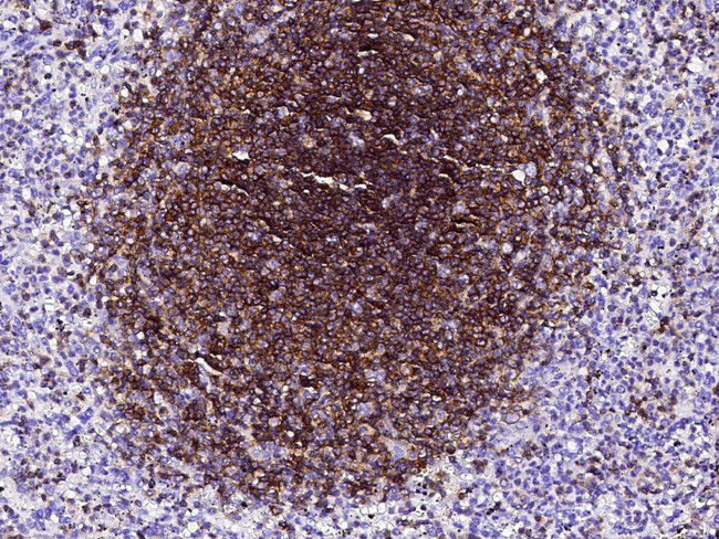 Ly-108 Antibody in Immunohistochemistry (Paraffin) (IHC (P))