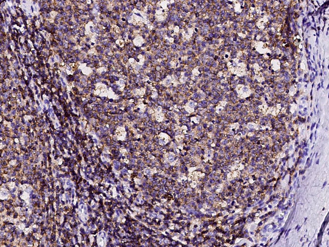 Ly-108 Antibody in Immunohistochemistry (Paraffin) (IHC (P))