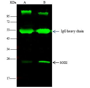 SOD2 Antibody in Immunoprecipitation (IP)