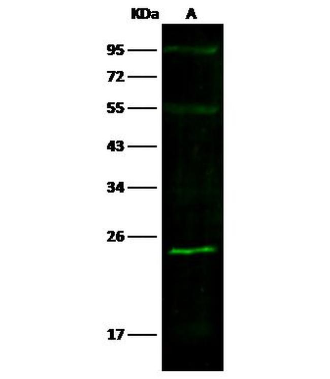 SOD2 Antibody in Western Blot (WB)