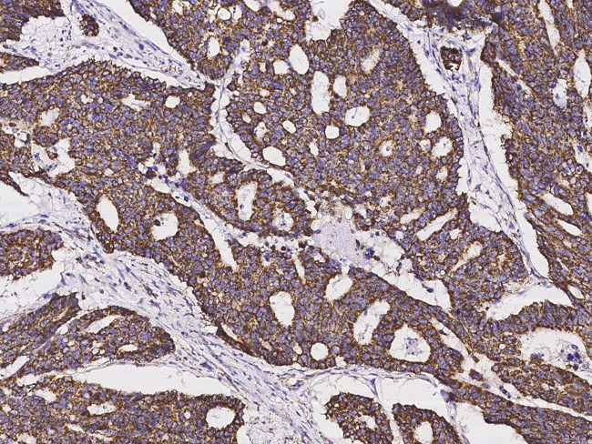 SOD2 Antibody in Immunohistochemistry (Paraffin) (IHC (P))