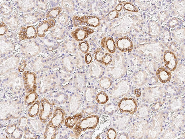 Osteopontin Antibody in Immunohistochemistry (Paraffin) (IHC (P))
