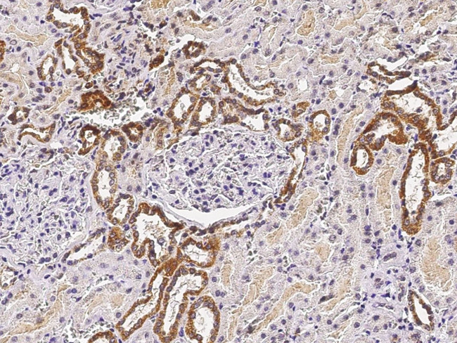 ST6GAL1 Antibody in Immunohistochemistry (Paraffin) (IHC (P))