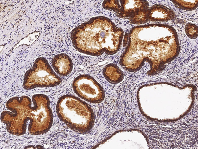 ST6GAL1 Antibody in Immunohistochemistry (Paraffin) (IHC (P))