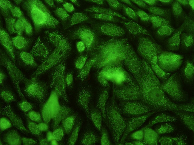 STAT6 Antibody in Immunocytochemistry (ICC/IF)