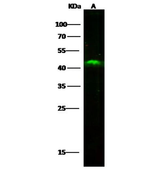 SULT2B1 Antibody in Western Blot (WB)