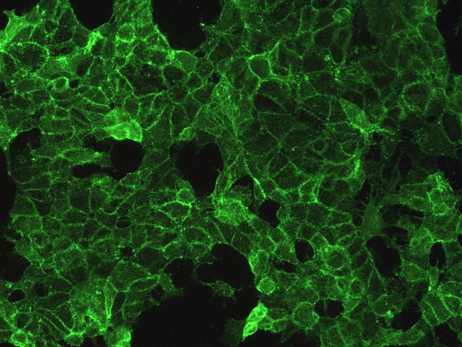 TROP2 Antibody in Immunocytochemistry (ICC/IF)