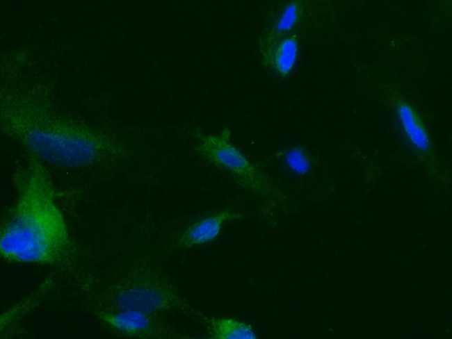 TEK Antibody in Immunocytochemistry (ICC/IF)