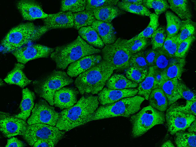 TFPI Antibody in Immunocytochemistry (ICC/IF)