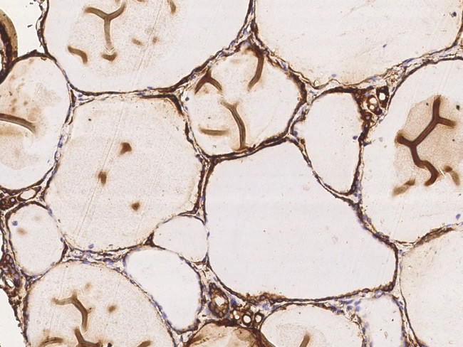 Thyroid Peroxidase Antibody in Immunohistochemistry (Paraffin) (IHC (P))