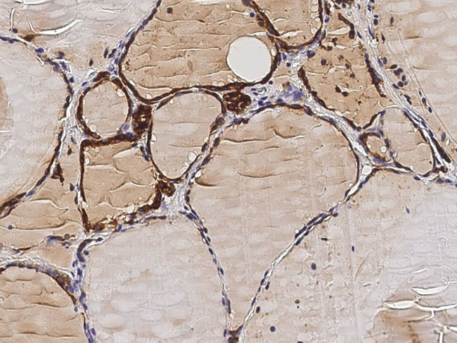 Thyroid Peroxidase Antibody in Immunohistochemistry (Paraffin) (IHC (P))