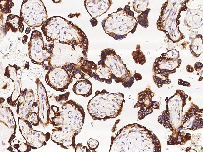 TNFAIP8 Antibody in Immunohistochemistry (Paraffin) (IHC (P))