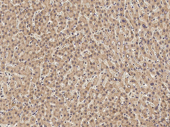 CD264 (TRAIL-R4) Antibody in Immunohistochemistry (Paraffin) (IHC (P))