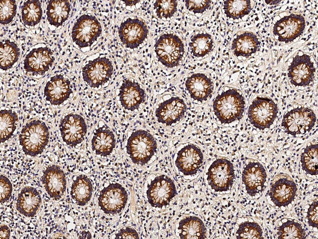 Thioredoxin 2 Antibody in Immunohistochemistry (Paraffin) (IHC (P))