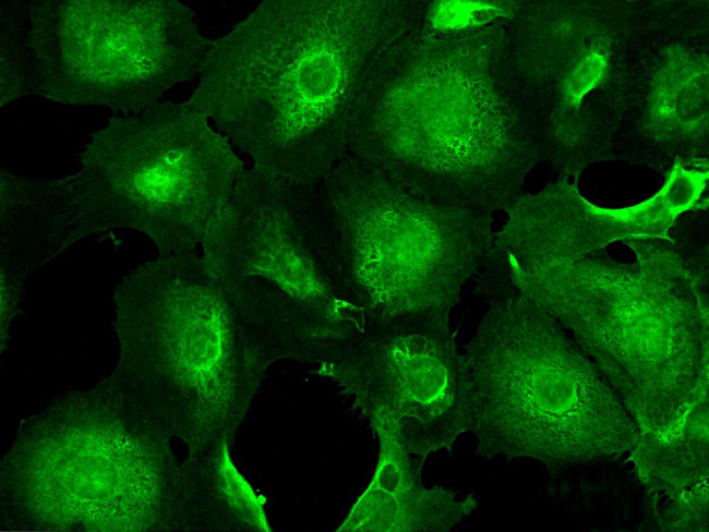 PGP9.5 Antibody in Immunocytochemistry (ICC/IF)