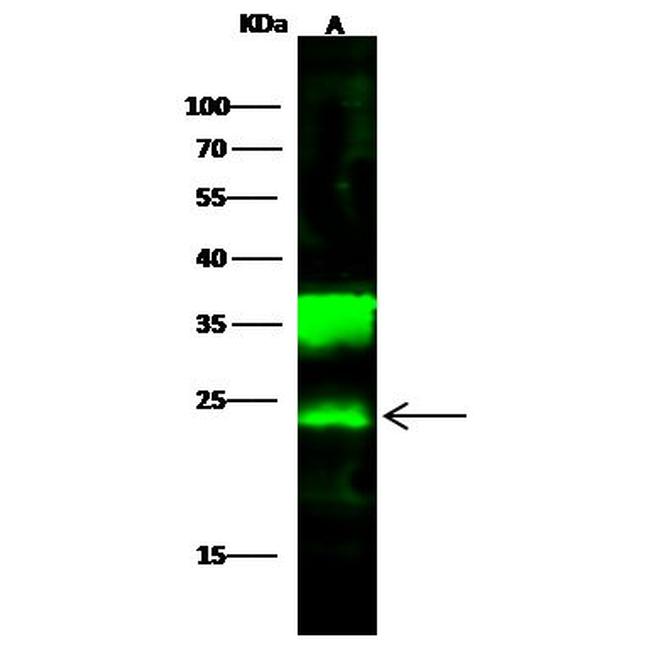 PGP9.5 Antibody in Western Blot (WB)