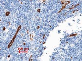 VWF Antibody in Immunohistochemistry (Paraffin) (IHC (P))