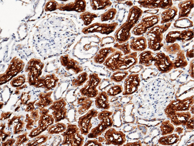 XPNPEP2 Antibody in Immunohistochemistry (Paraffin) (IHC (P))