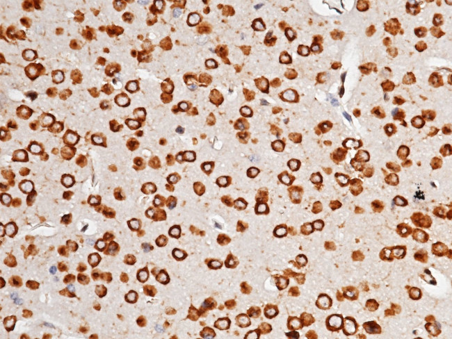 AGO2 Antibody in Immunohistochemistry (Paraffin) (IHC (P))