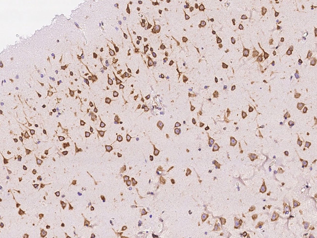 AGO2 Antibody in Immunohistochemistry (Paraffin) (IHC (P))