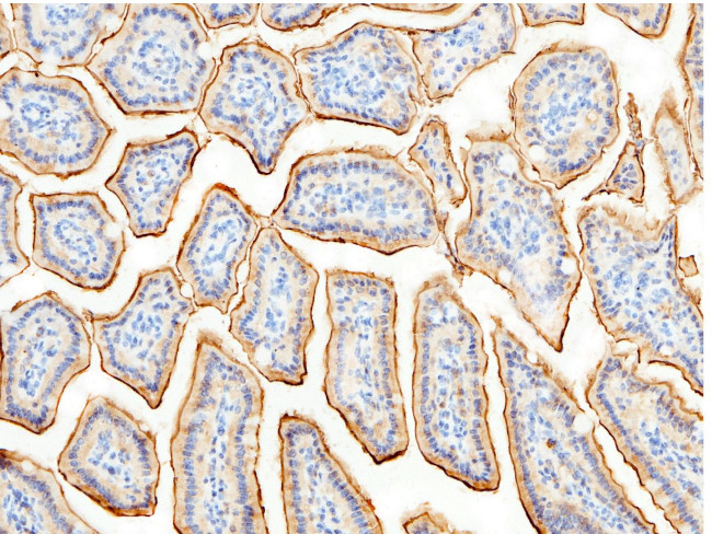 CD13 Antibody in Immunohistochemistry (Paraffin) (IHC (P))