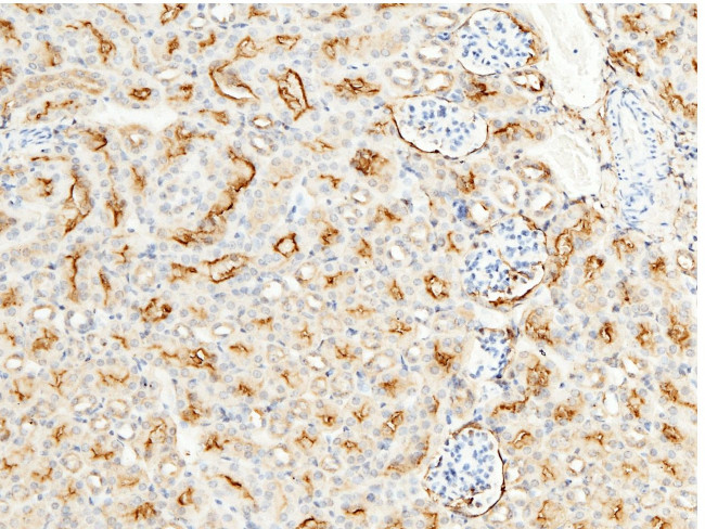 CD13 Antibody in Immunohistochemistry (Paraffin) (IHC (P))