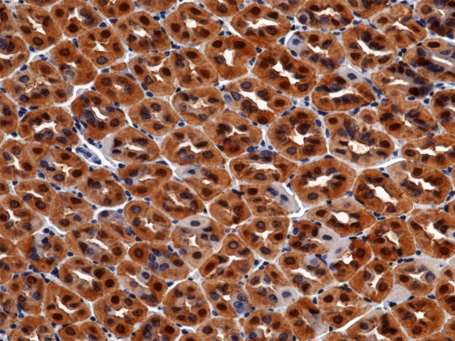 Carbonic Anhydrase II Antibody in Immunohistochemistry (Paraffin) (IHC (P))