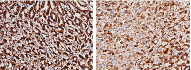 Carbonic Anhydrase IX Antibody in Immunohistochemistry (Paraffin) (IHC (P))