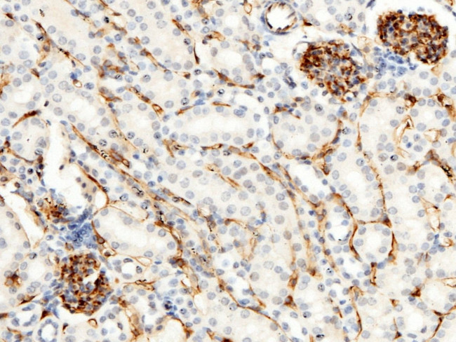 CD34 Antibody in Immunohistochemistry (Paraffin) (IHC (P))