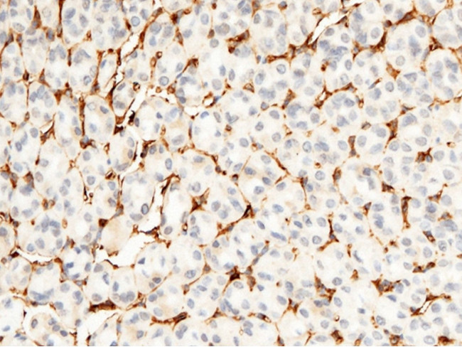 CD34 Antibody in Immunohistochemistry (Paraffin) (IHC (P))