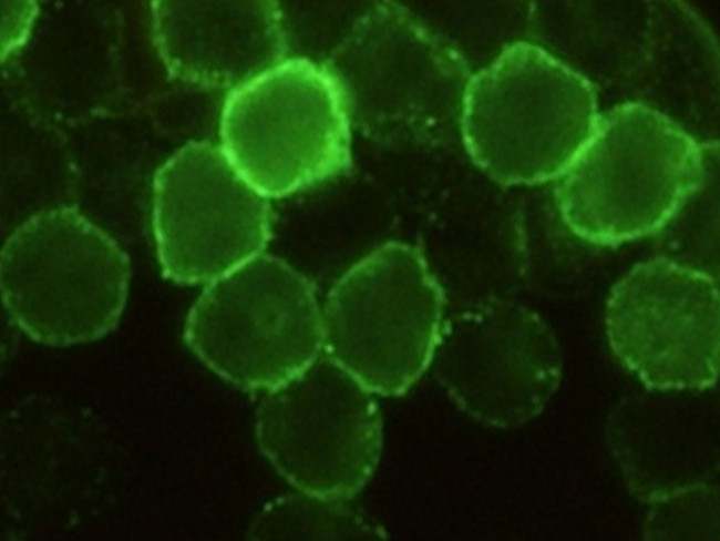 CD6 Antibody in Immunocytochemistry (ICC/IF)