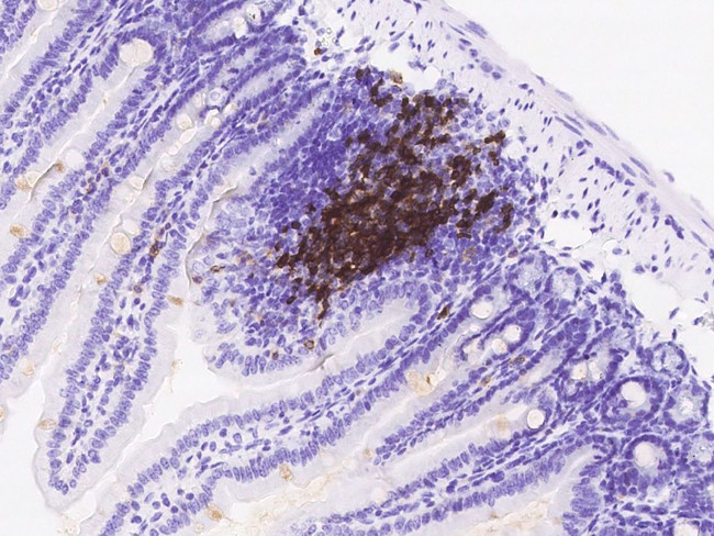 CD79b Antibody in Immunohistochemistry (Paraffin) (IHC (P))