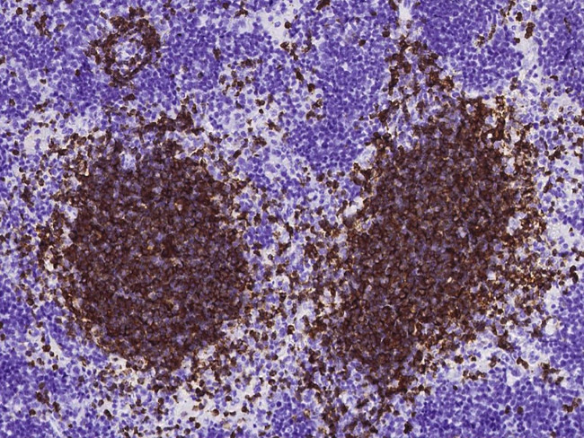 CD79b Antibody in Immunohistochemistry (Paraffin) (IHC (P))