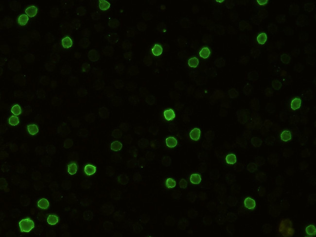 CD8 alpha Antibody in Immunocytochemistry (ICC/IF)