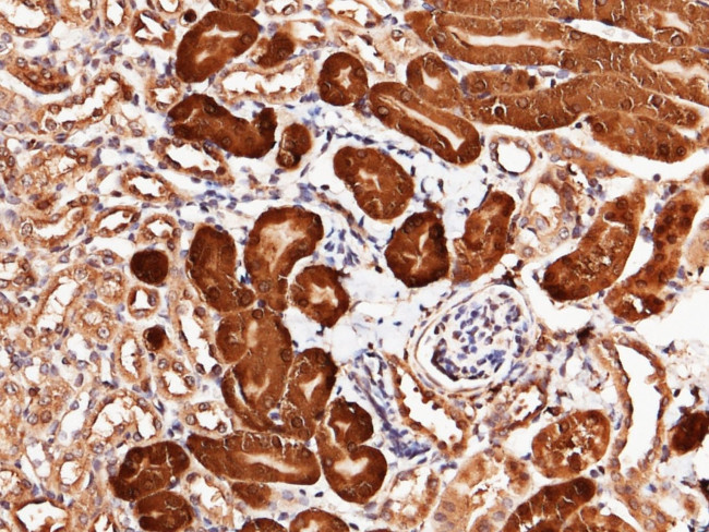 CNDP2 Antibody in Immunohistochemistry (Paraffin) (IHC (P))