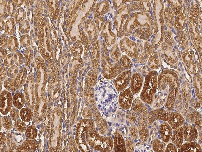 Cathepsin B Antibody in Immunohistochemistry (Paraffin) (IHC (P))