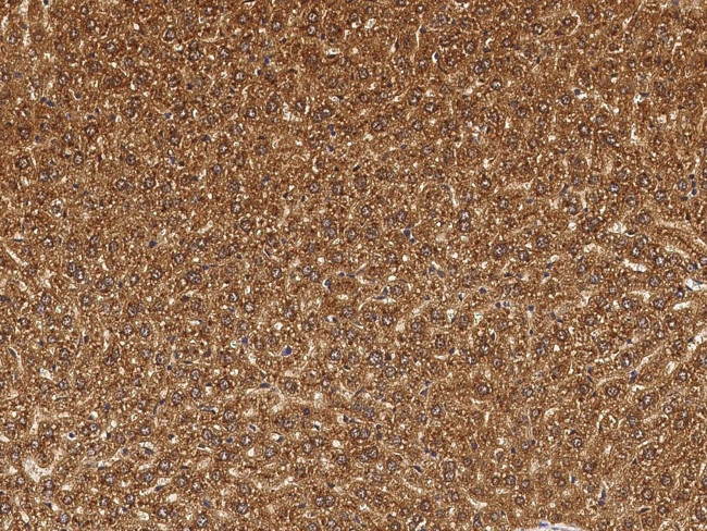 Cathepsin B Antibody in Immunohistochemistry (Paraffin) (IHC (P))