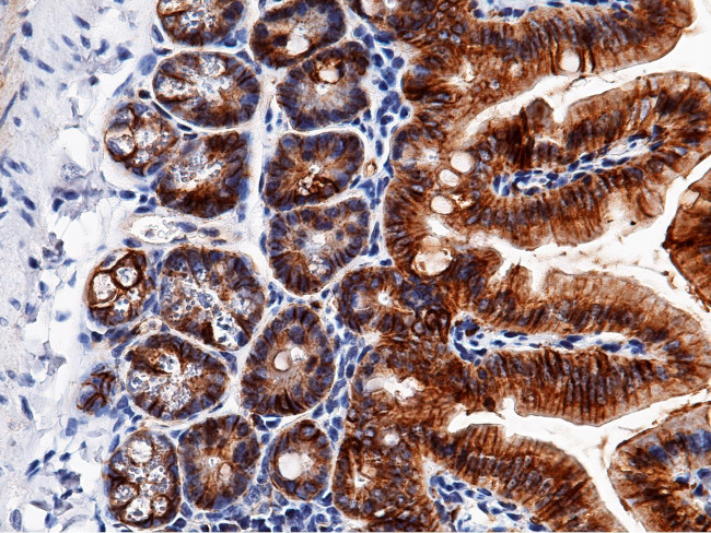 EpCAM Antibody in Immunohistochemistry (Paraffin) (IHC (P))