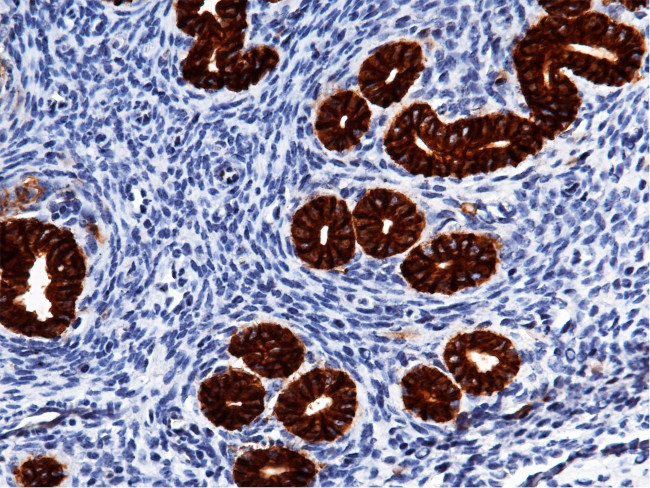 EpCAM Antibody in Immunohistochemistry (Paraffin) (IHC (P))