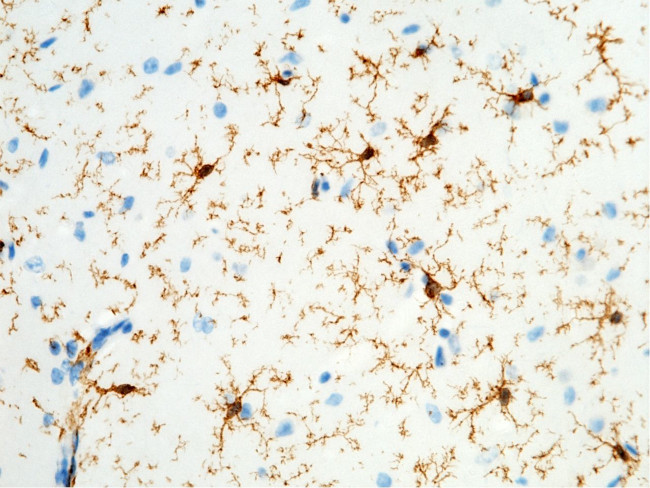 CD64 Antibody in Immunohistochemistry (Paraffin) (IHC (P))