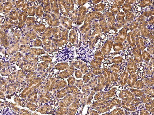 Growth Hormone Receptor Antibody in Immunohistochemistry (Paraffin) (IHC (P))